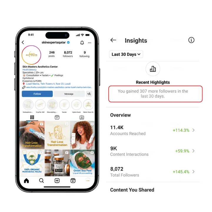 Skin Masters Instagram profile beside its 30-day insights